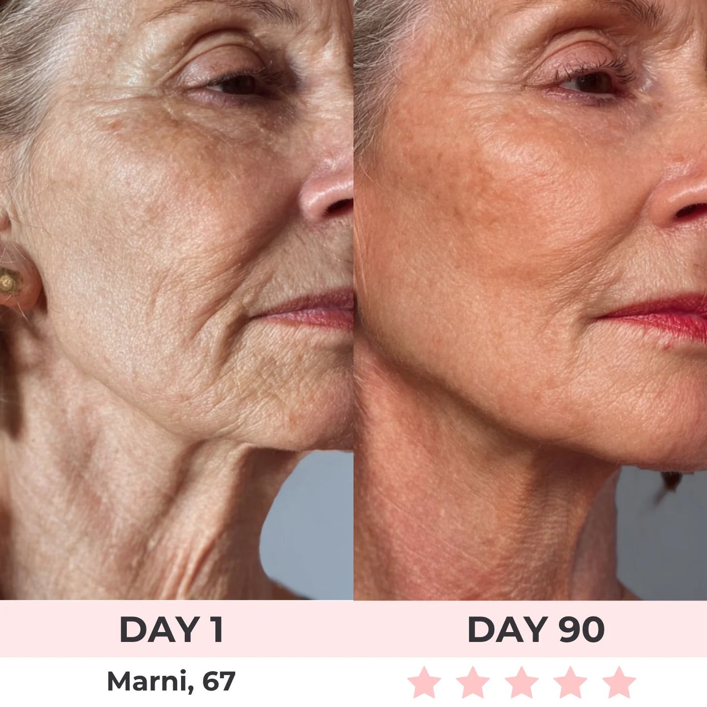 SkinBelle™ Bastón Facial Antiarrugas