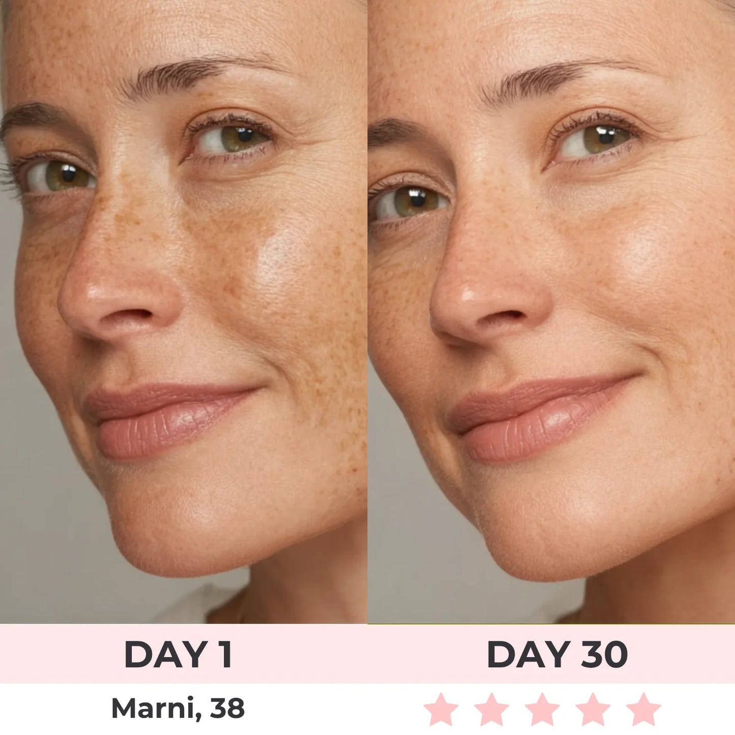 SkinBelle™ Bastón Facial Antiarrugas