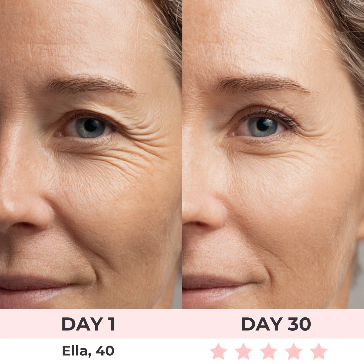 SkinBelle™ Bastón Facial Antiarrugas