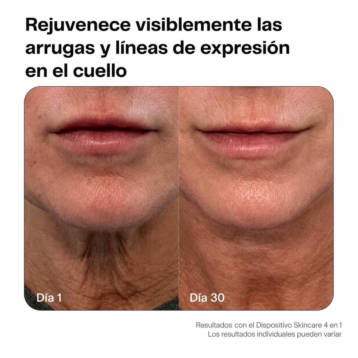 SkinBelle™ Bastón Facial Antiarrugas